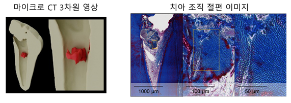  [뉴스] 옥시토신수용체를 통한 새로운 치아 재생 전략 제시