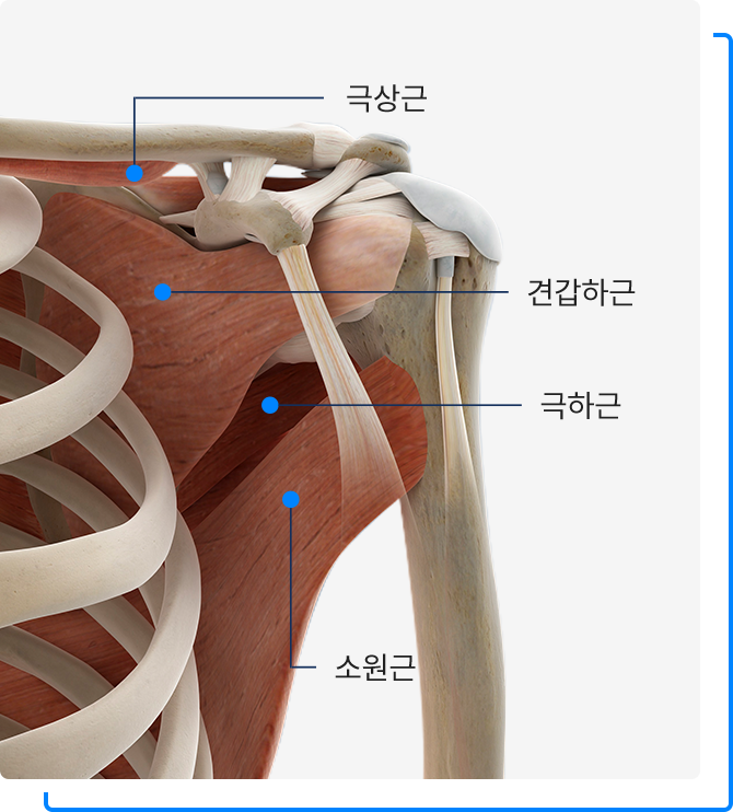 회전근개파열, 증상과 치료를 바로 알자. (어깨충돌증후군과 차이점) : 네이버 블로그