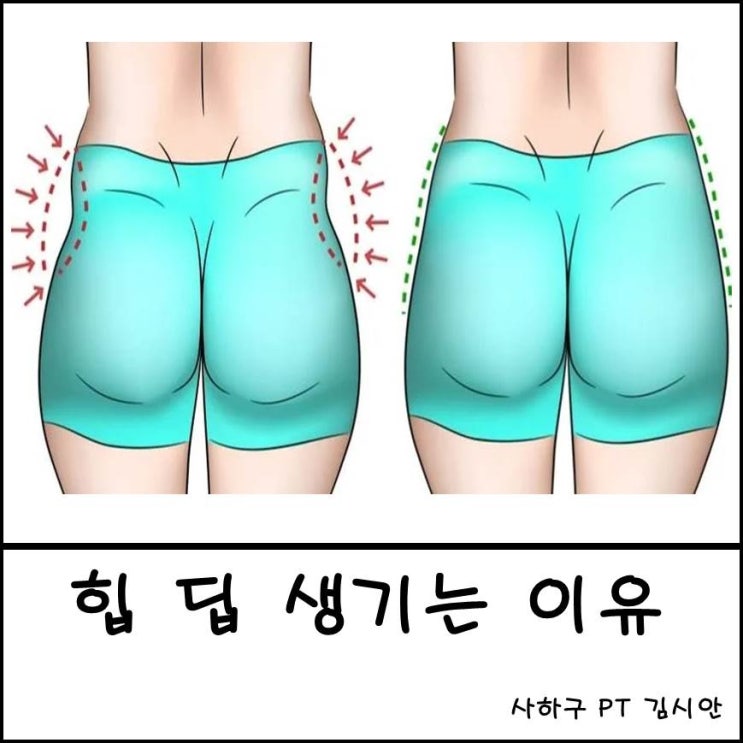 힙 딥 생기는 이유