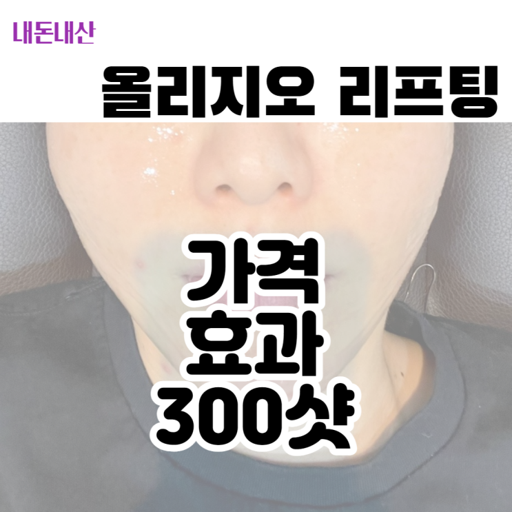  올리지오 내돈내산 리프팅 후기