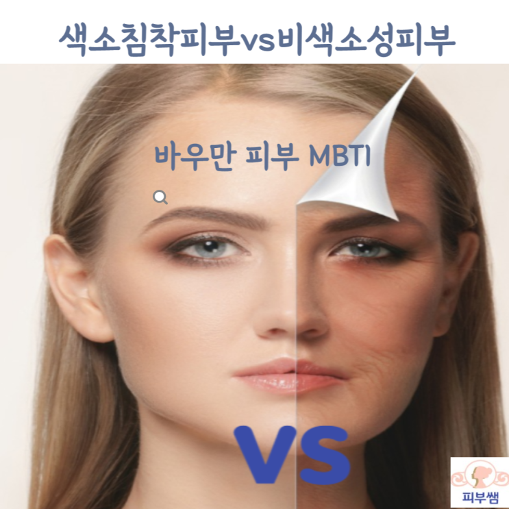 피부타입 테스트 바우만 피부 MBTI 색소침착 피부 vs 비색소성 피부