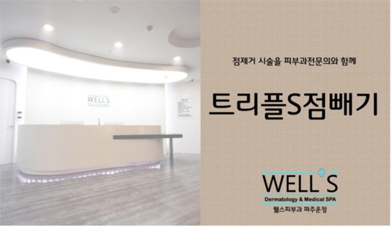 파주 레이저 점제거 & 피부과 삼중 점 제거 – 웰스피부과
