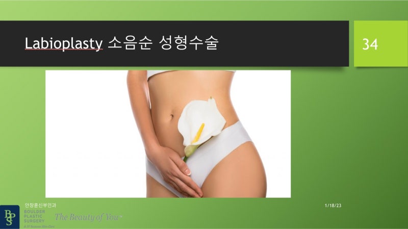 기능의학적 르누아르 소음순 형성 수술