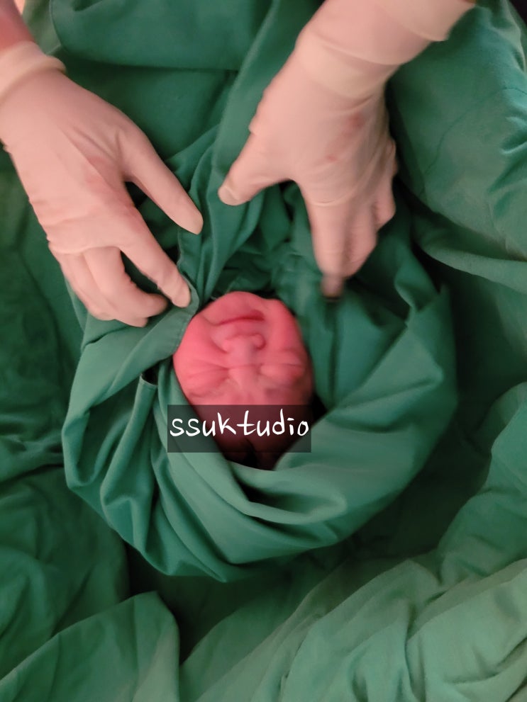  [쑥쑥이일기 #22] 39주 3일차 오늘 가능합니다 당장 입원하께요