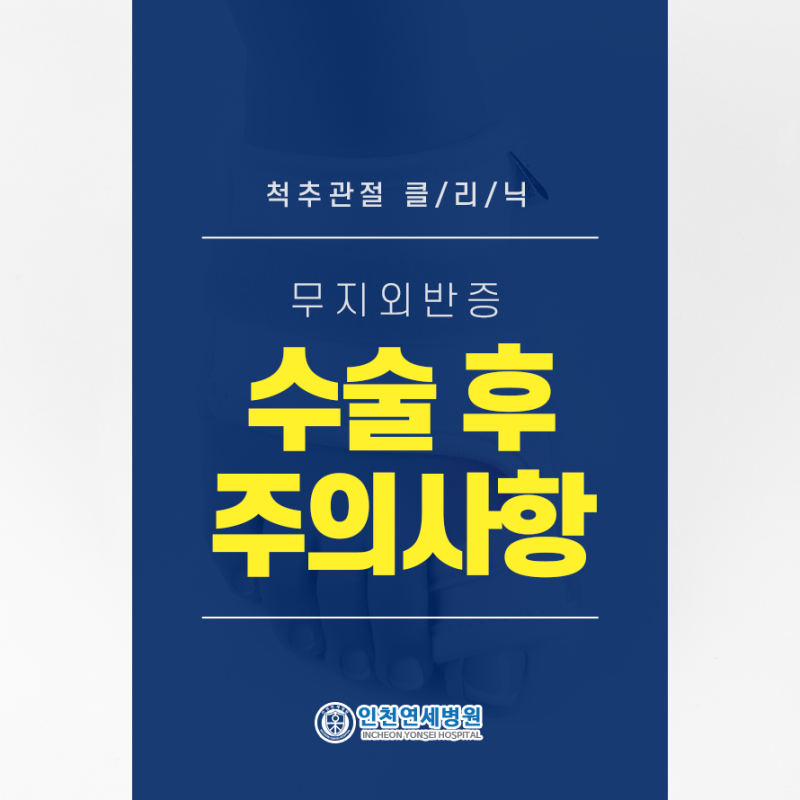 인천 무지외반증, 무지외반증 수술후 주의해야할 사항?