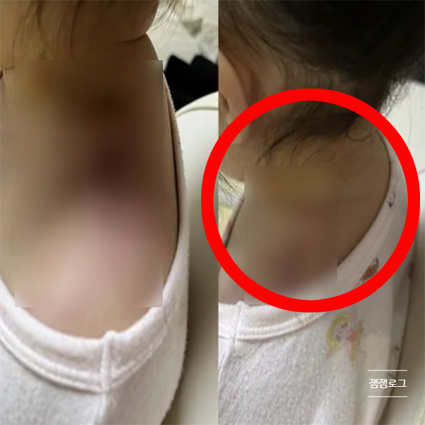  안산 어린이집 보육교사 아동학대 어깨 피멍 CCTV 어디 위치