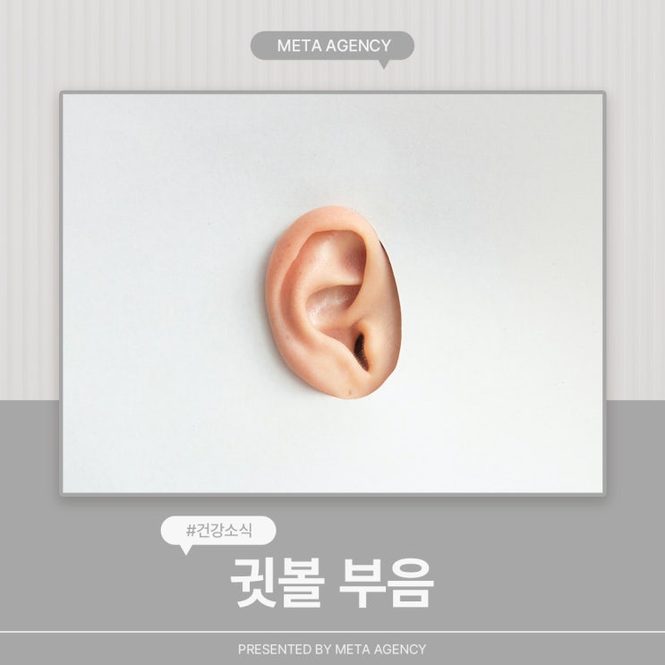  귓볼 부음 원인과 대처방법