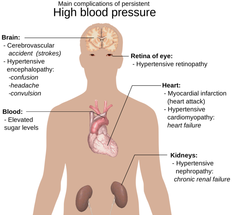  콩팥 신장 기능(신장질환 초기증상 신장병 치료 예방법)