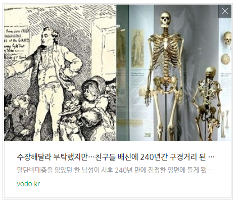 "수장해달라" 부탁했지만…친구들 배신에 240년간 구경거리 된 거인병男 그 후