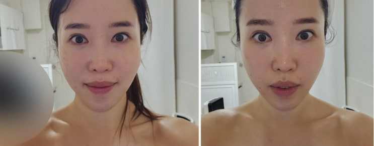  왕십리 피부관리 시하뷰티에서 브이핏입체윤곽케어 후기