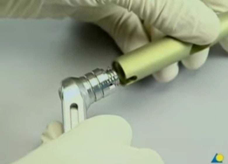 수술실 정형외과 스크럽- Femur fx CRIF(PFNA -2) nail insertion -PFNA procedure ...