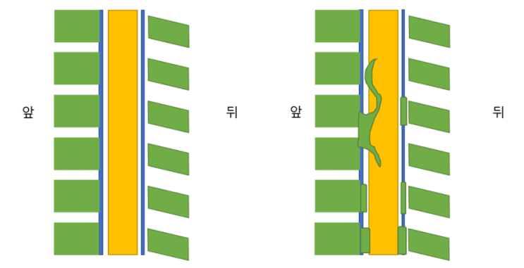  팔다리 둔함, 대소변 장애, 팔에 힘 빠지는 증상