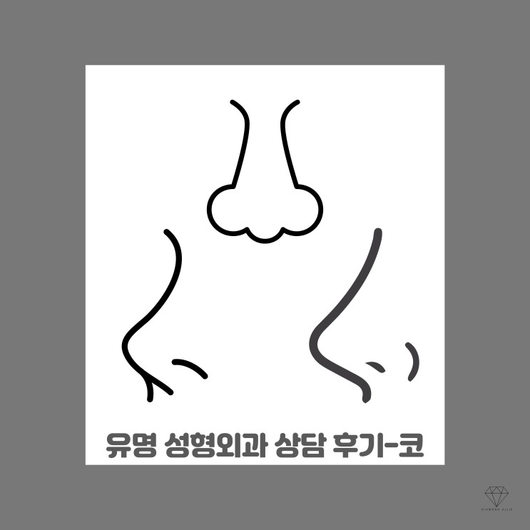 강남 유명 성형외과 5군데 상담 후기 - 코