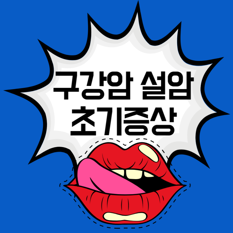 구강암 설암 초기증상 원인 살펴보고 설암에 좋은 음식으로 예방하세요 구강암 설암 초기증상 원인 살펴보고 설암에 좋은 음식으로 예방하세요