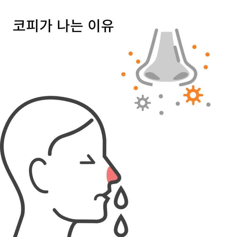 코피가 자주나는 이유 코피 원인 지혈방법 폰 빌레브란트병 겨울철 코피 : 네이버 블로그