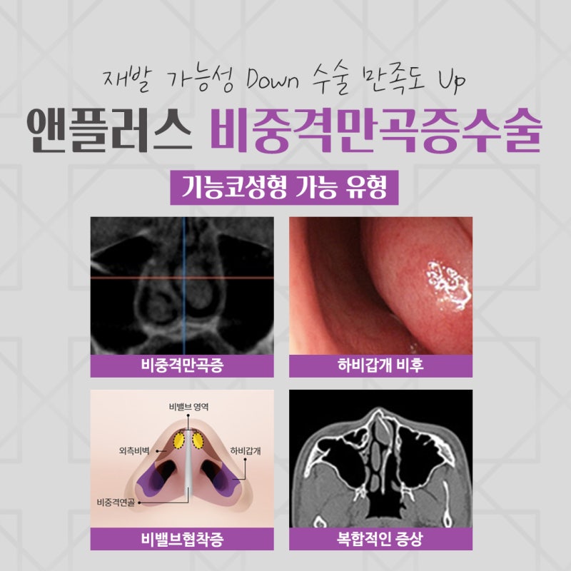 비중격코성형수술 구조적인 문제라면
