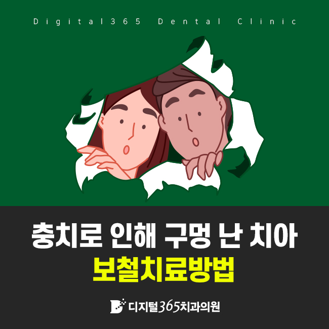  충치로 인해 구멍 난 치아 보철치료방법