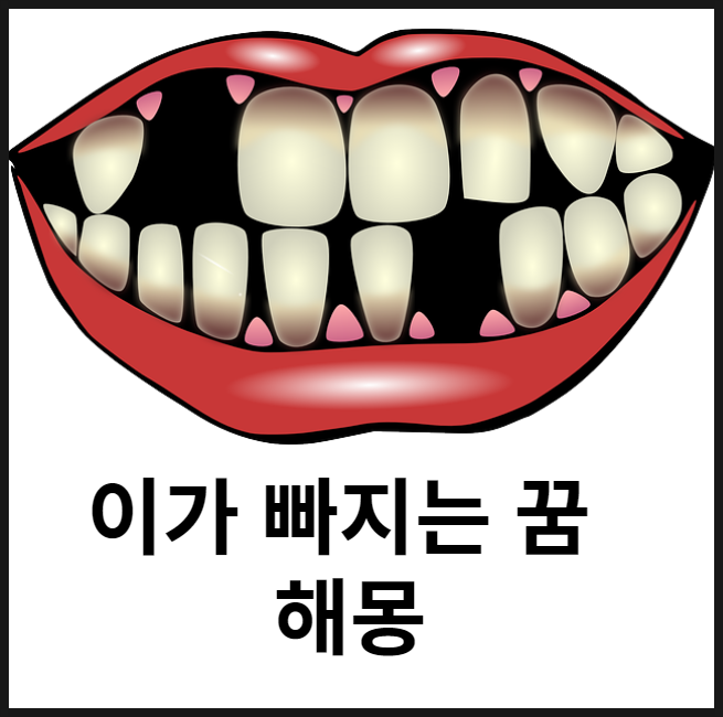  이빨 빠지는 꿈 해몽 ( 아랫니, 치아 일부, 윗니와 아랫니, 앓던 이, 썩은 이, 치아가 검고 누렇게, 치아가 빠져 삐가 나는 해몽 풀이 )