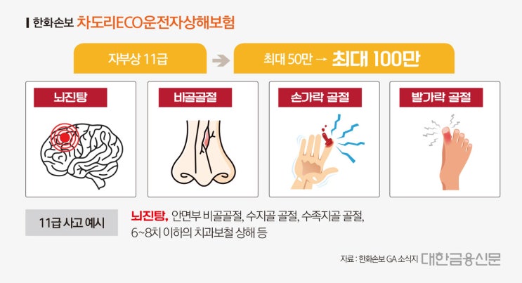 '자부상 보험’ 모럴해저드 이제 뇌진탕서 들썩 '자부상 보험’ 모럴해저드 이제 뇌진탕서 들썩