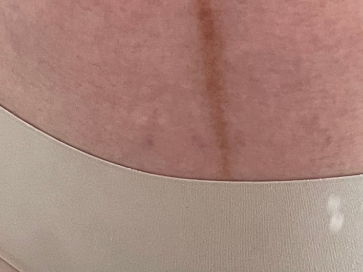 임신 24주차 증상일기(튼살, 후비루, 모임, 어푸어푸, 오버더문카페, 쩜오민박, 영화관, 명륜진사갈비)