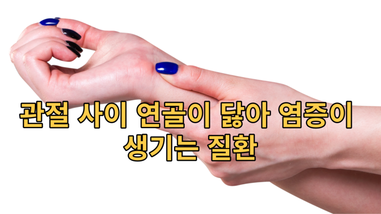  류마티스 관절염 이겨내기