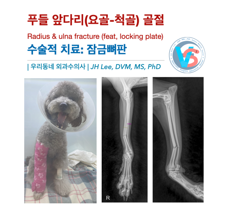  푸들 강이지 앞다리(요골-척골) 골절 (Radius & ulna fracture; feat, locking plate)