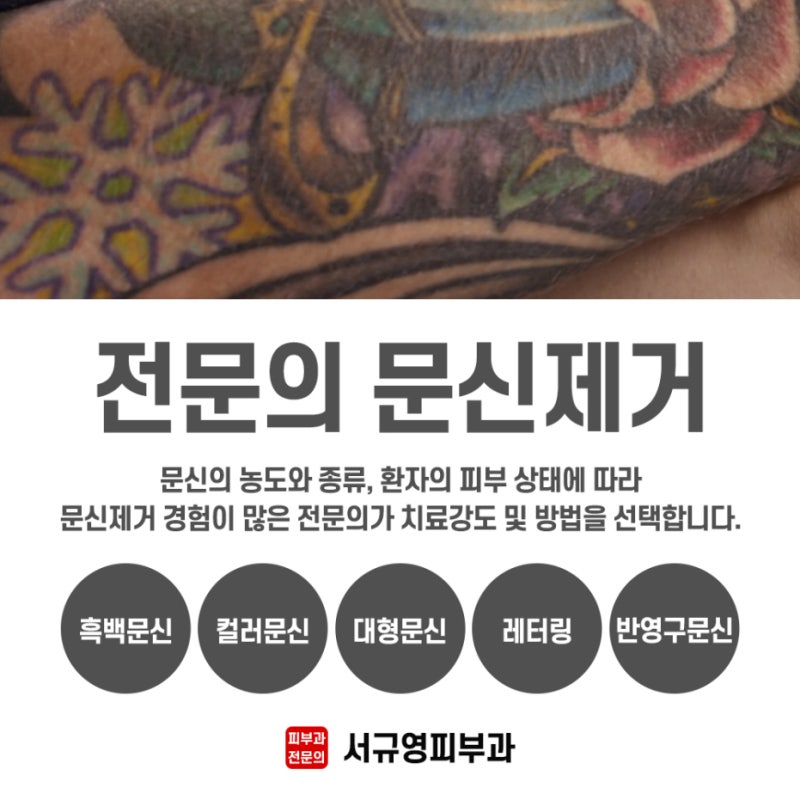 구미계피부과_문신제거, 문신레이저 마이크로레이저 그리고 이것! 구미계피부과_문신제거, 문신레이저 마이크로레이저 그리고 이것!
