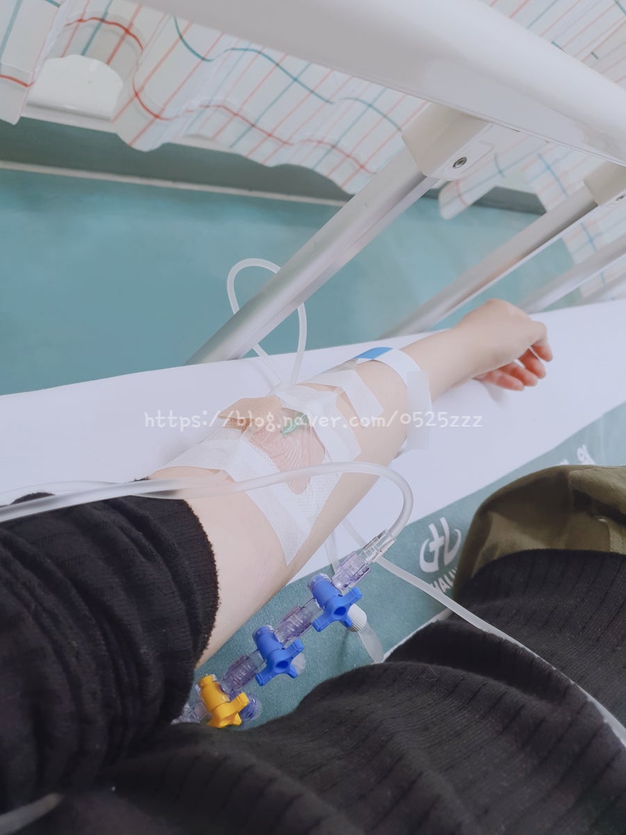 [맹장수술 후기1]맹장수술 국소복막염을 동반한 급성 충수염 수술 후기 맹장염 증상 보험비 보험료 수술비 보험청구 관련 사진