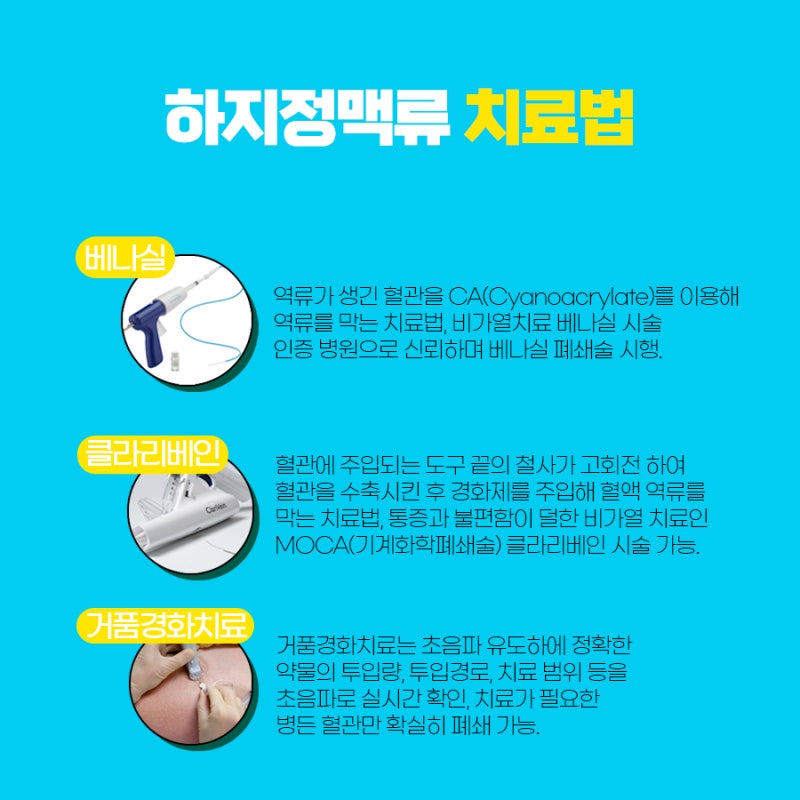 창원 하지정맥류가 있다면 다리 통증이 있다면