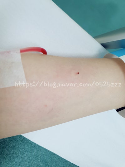 [맹장수술 후기2]맹장수술 국소복막염을 동반한 급성 충수염 수술 후기 맹장염 증상 보험비 보험료 수술비 보험청구 관련 사진