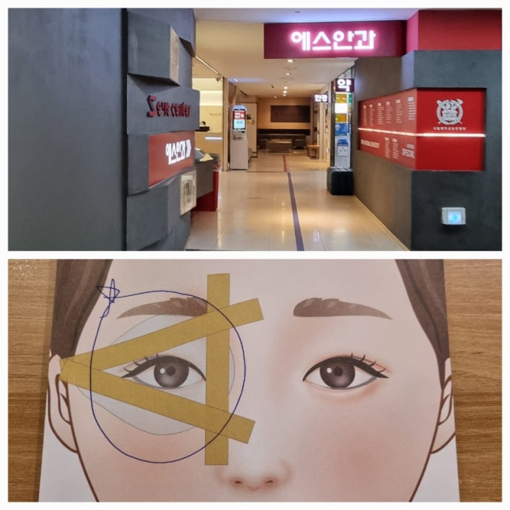  엄마 백내장 검사 중앙역 안산 에스안과 사람 정말 많네요