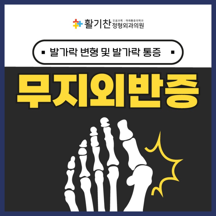  구산동통증의학과 엄지발가락에 통증이?