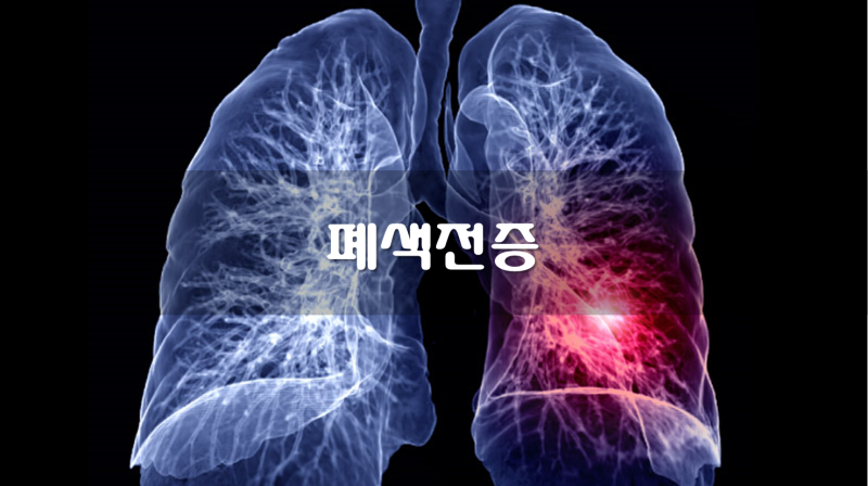 릭시아나 릭시아나정 항응고제 정맥혈전색전증 폐색전증 심방세동 혈전 생성 예방 성분 효능 효과 복용법 부작용 주의사항 15mg ...