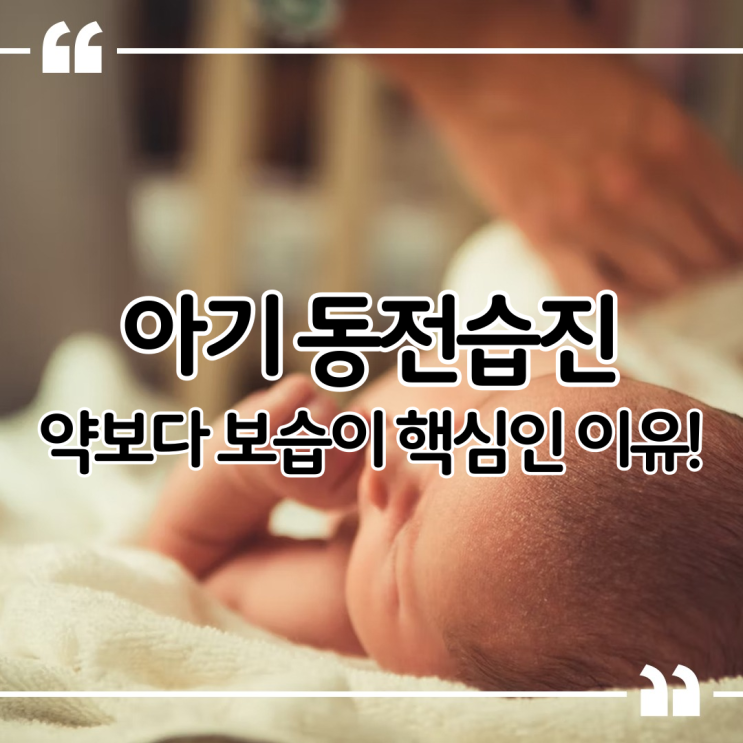  아기 동전습진 약보다 보습이 더 중요한 이유!