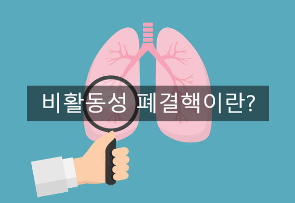 비활동성 폐결핵이란
