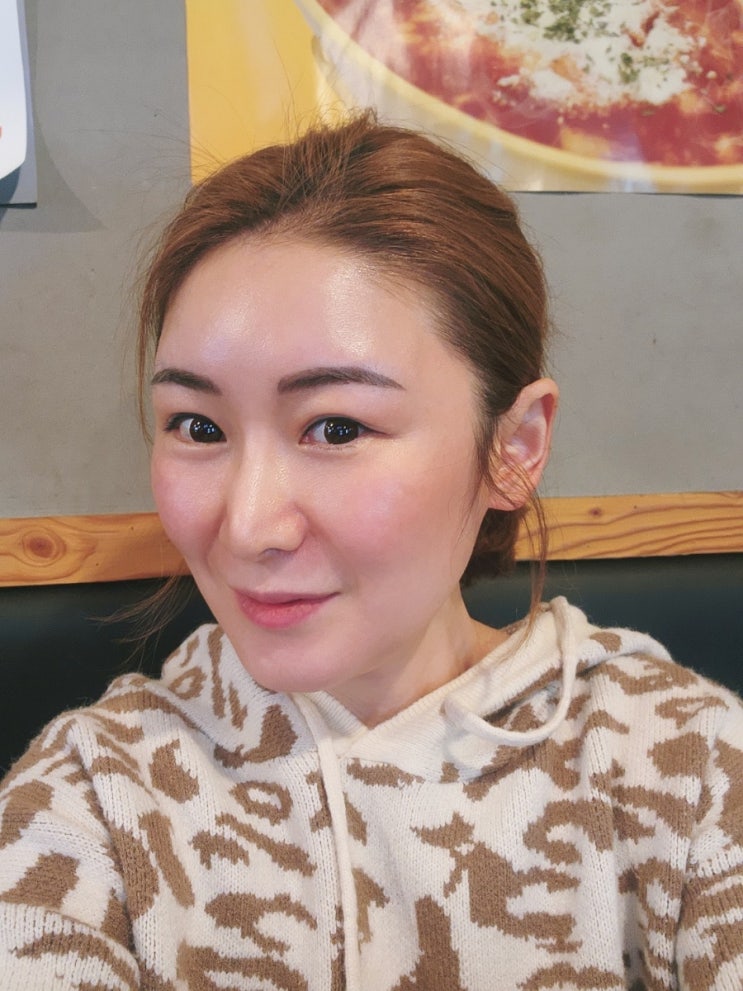  미라젯 리쥬란힐러 압구정 피부과 피부 관리 물광주사 가격 효과 통증 추천 후기