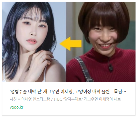 ‘성형수술 대박 난’ 개그우먼 이세영, 고양이상 매력 물씬...日남친도 깜짝 놀랄 판 ‘성형수술 대박 난’ 개그우먼 이세영, 고양이상 매력 물씬...日남친도 깜짝 놀랄 판