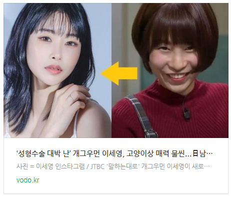 ‘성형수술 대박 난’ 개그우먼 이세영, 고양이상 매력 물씬...日남친도 깜짝 놀랄 판