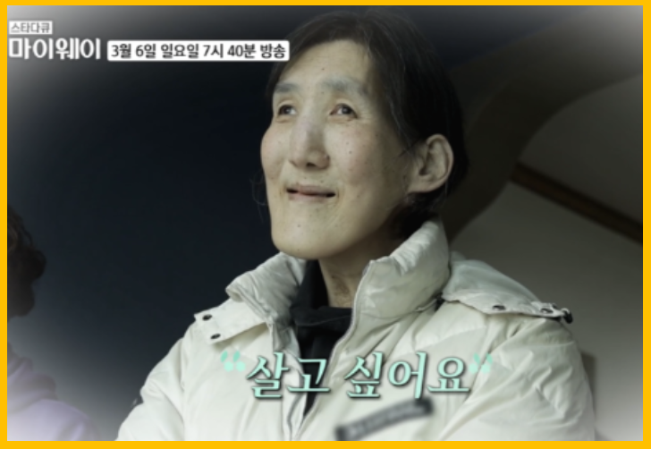  농구선수 김영희 별세 거인병 말단비대증이란?