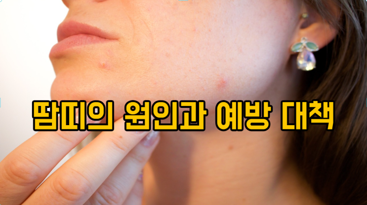  땀띠의 원인과 예방 대책