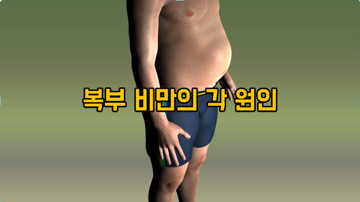 복부 비만의 원인과 예방