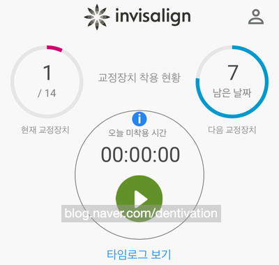 마이 인비절라인 앱 사용방법 - 교체 시기와 착용시간 추적 가이드 (액세서리샵 쿠폰 코드 공개) "My Invisalign"