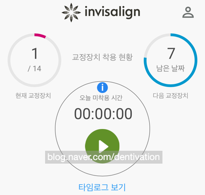  마이 인비절라인 앱 사용방법 - 교체 시기와 착용시간 추적 가이드 (액세서리샵 쿠폰 코드 공개) "My Invisalign"