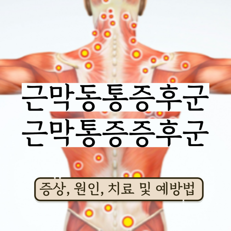 근막동통증후군 근막통증증후군 증상, 원인, 치료 및 예방법 : 네이버 블로그