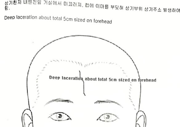 이마가 찢어져 피부, 근육까지 봉합 상해수술비, 종수술비 청구사례 이마가 찢어져 피부, 근육까지 봉합 상해수술비, 종수술비 청구사례