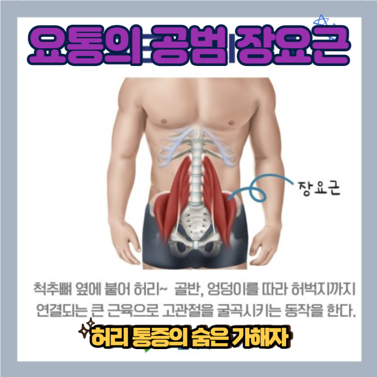 요통이 있다면 반드시 풀어 줘야 할 장요근: 스트레칭 & 마사지 & 근력운동