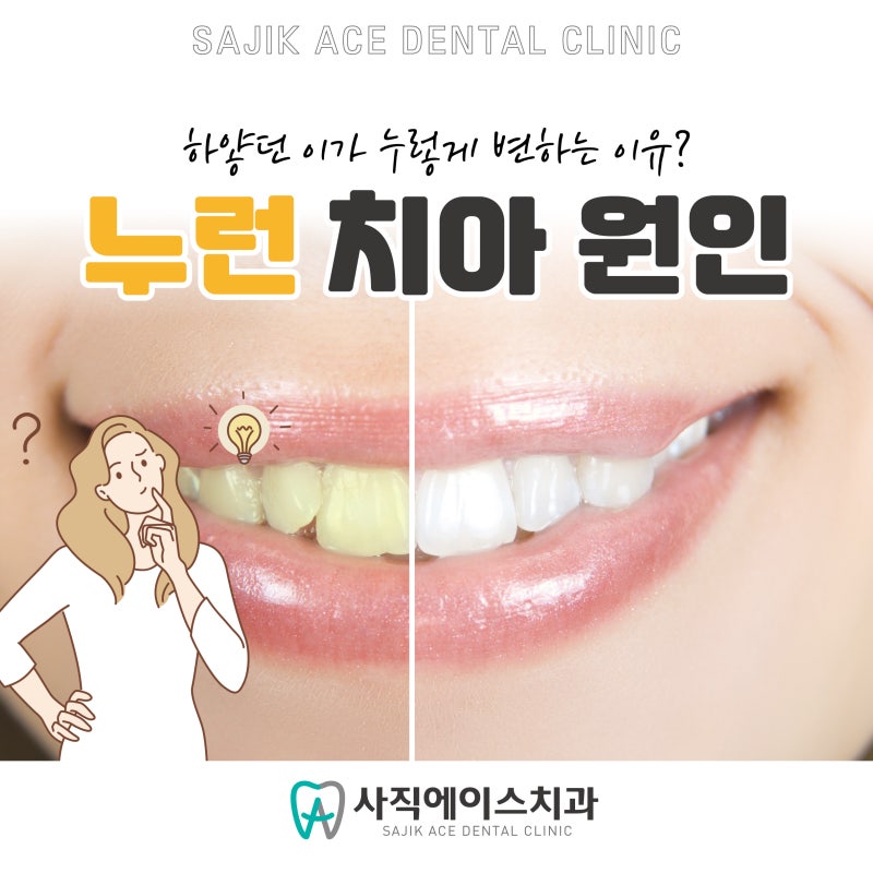 치아가 노랗게 변하는 원인은 무엇입니까?