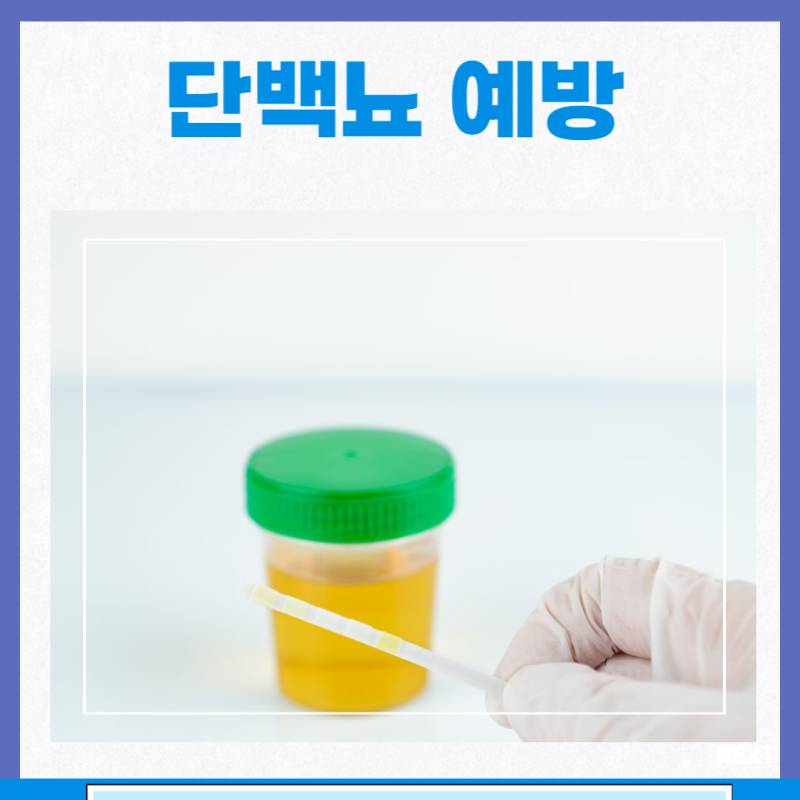 거품뇨 단백뇨 원인 검사 치료 예방 아침 소변 거품 : 네이버 블로그