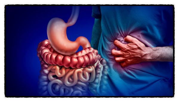 크론병(Crohn's disease) 원인과 초기 증상 그리고 치료방법과 좋은 음식 나쁜 음식