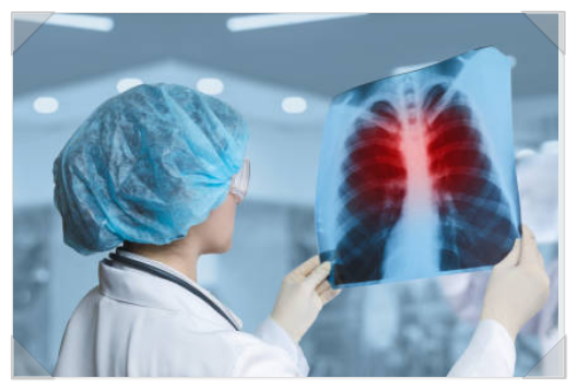 폐렴(Pneumonia)의 치료 기간과 약 그리고 아이들과 코로나의 위험성